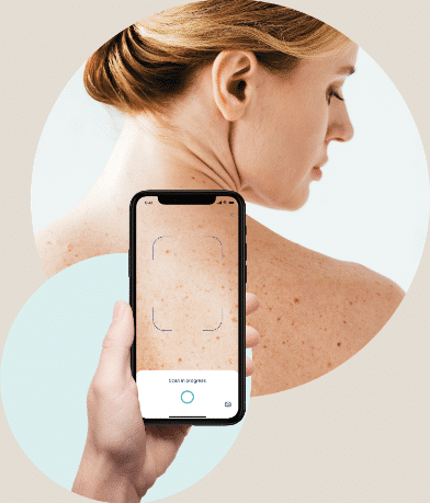 Smartphone scannt Haut auf Muttermale.